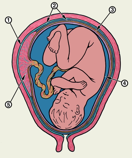 Схематическое изображение расположения плодных оболочек в матке в конце беременности: 1 — базальная децидуальная оболочка, 2 — соприкасающиеся капсулярная и париетальная децидуальные оболочки, 3 — гладкий хорион, 4 — амнион, 5 — <a href=