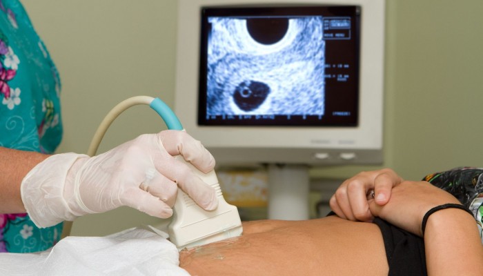 Sonographer technician holds an ultrasound transducer to diagnose the condition of a pregnant woman with a view of the woman