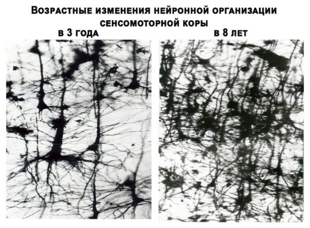 Детский сад в 1970 годы