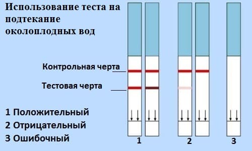 Тест на подтекание околоплодных вод (преждевременное излитие околоплодных вод)