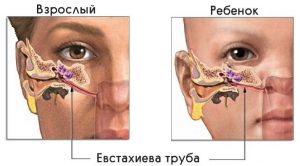 Как показано на рисунке, у ребенка евстахиева труба расположена по-другому, по этому у детей чаще возникают ушные инфекции и заболевания